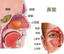 【全國愛鼻日】孩子出現(xiàn)這些癥狀，警惕鼻竇炎！